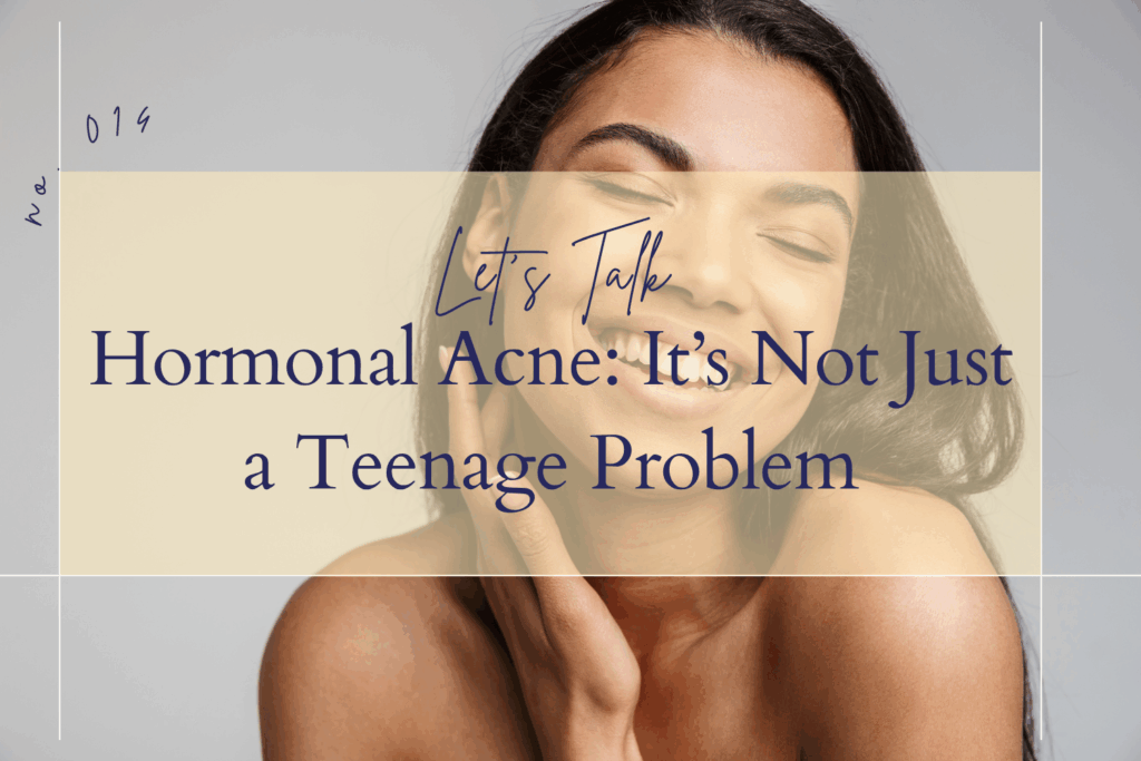 hormonal-acne, woman-smiling, healthy-skin, get-rid-of-pimples, how-to-heal-my-hormones
